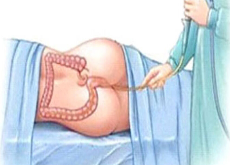 Aasthapana Vasthi treatment at Marsha Ayurvedam